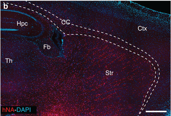 In this image, taken from the original study, each red dot is a human glial cell in an adult mouse brain - the text and lines indicate different brain regions.