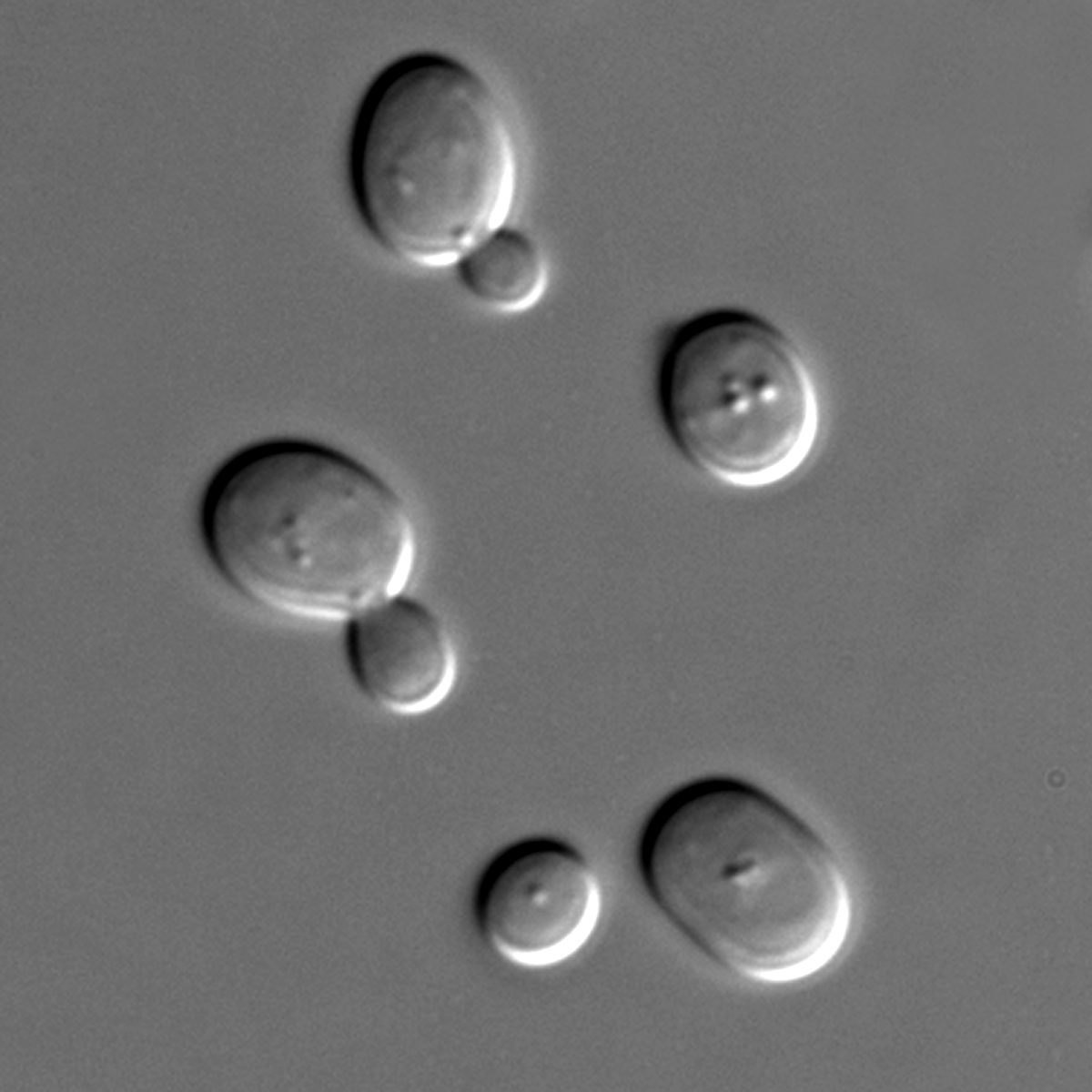 Tiny yeast cells helped Giorgini and colleagues find proteins that protect cells from the mutant huntingtin protein.  