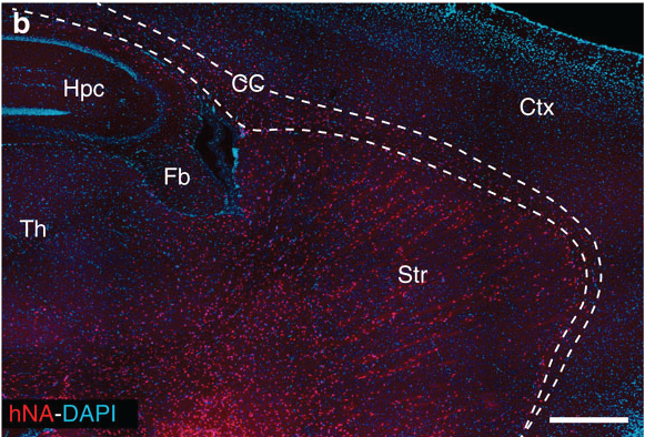 In this image, taken from the original study, each red dot is a human glial cell in an adult mouse brain - the text and lines indicate different brain regions.  