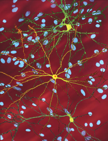 Images of neurons in culture from the Finkbeiner lab. Cells in green and yellow have been 'tagged' so they glow, revealing the shape of the cells.