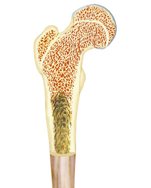 Mesenchymal stem cells are harvested from bone marrow