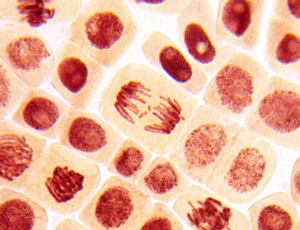 Cancer occurs when cells divide in an uncontrolled way. Increasingly we understand that this is often because of differences in our DNA. Now it looks like the genetic abnormality that causes HD might have a link to the development of cancer.