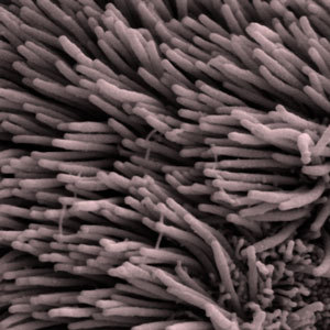 Cilia are tiny hair-like projections on our cells. Different tags cause huntingtin to interact with the cilia in different ways.
