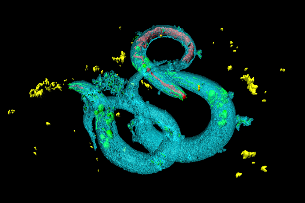 Mallucci's team identified 2 top candidates from testing over a thousand drugs in worms called C elegans.