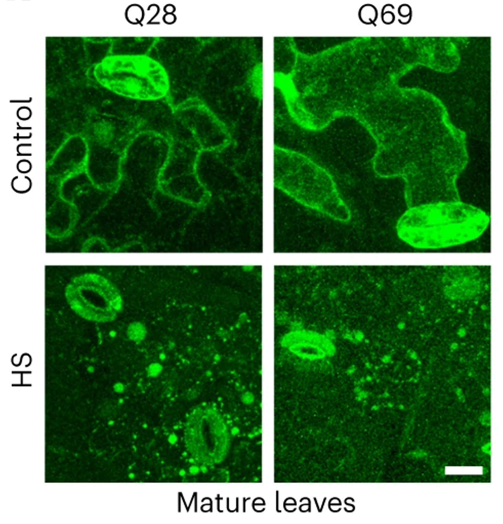 The scientists looked at plants under the microscope to see where the huntingtin protein, visualised in green here, was found under normal (control) and heat shock (HS) conditions - very cool!!