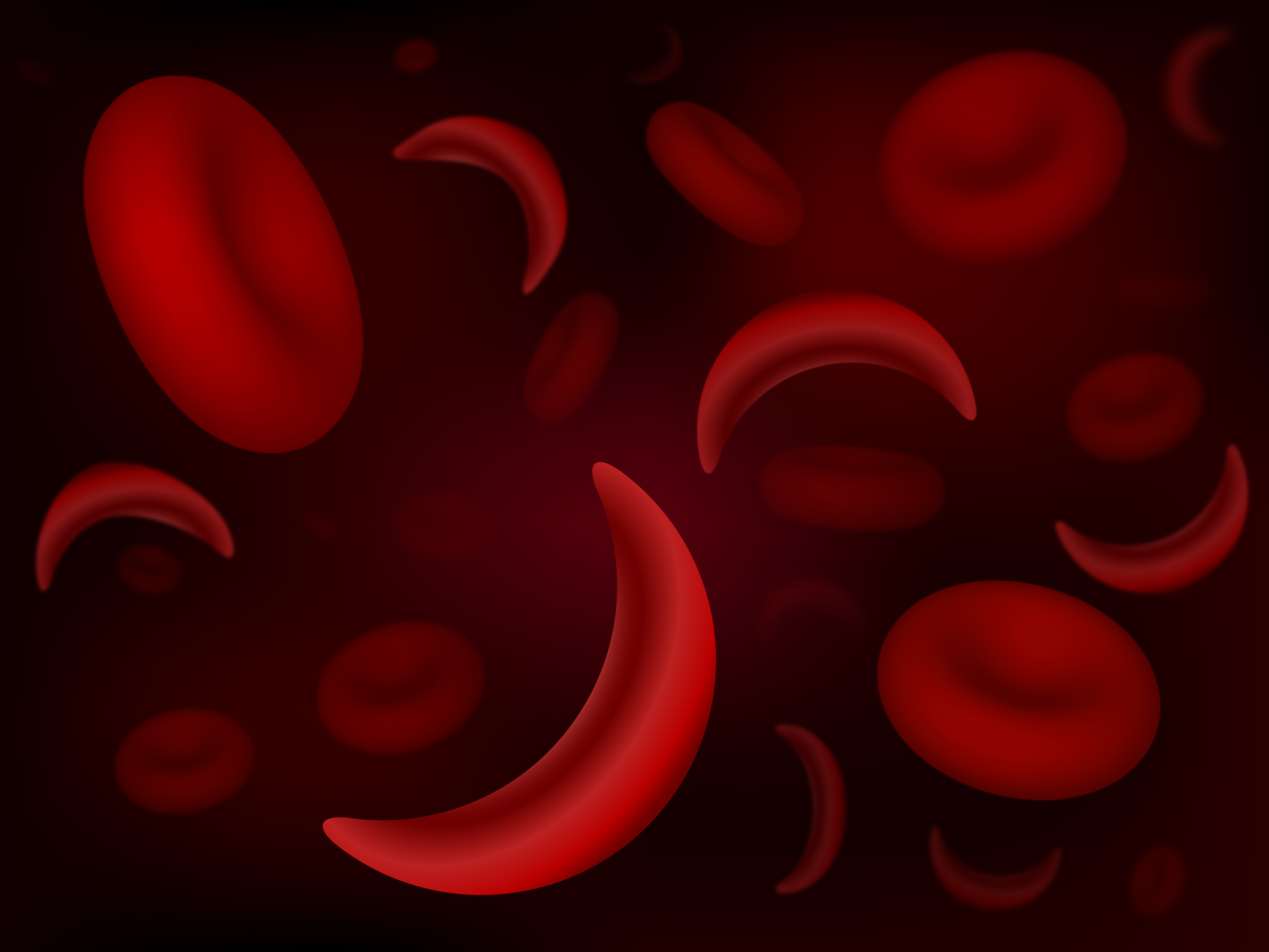 Sickle Cell Disease causes red blood cells to adopt a âCâ or sickle-like shape. People with this disease lack a protein that gives the red blood cells a rigid shape that helps them carry oxygen throughout the body. Carrying less oxygen means that people with Sickle Cell Disease have fewer red blood cells and can experience clogged blood vessels and potentially stroke.
