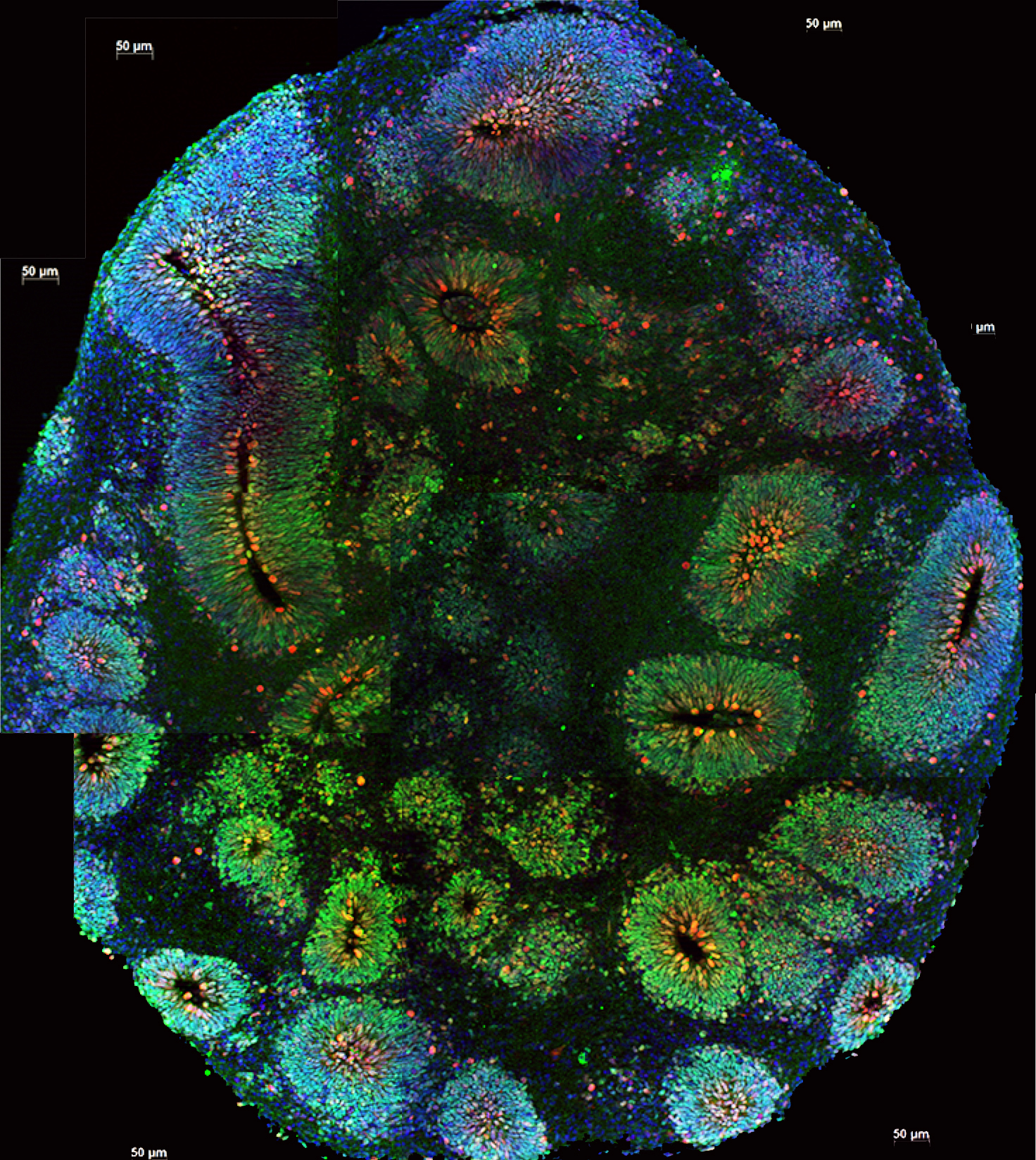 Using tags that glow, researchers can light up different cells and their connections within brain organoids. A world of information is held in these tiny spheres!   