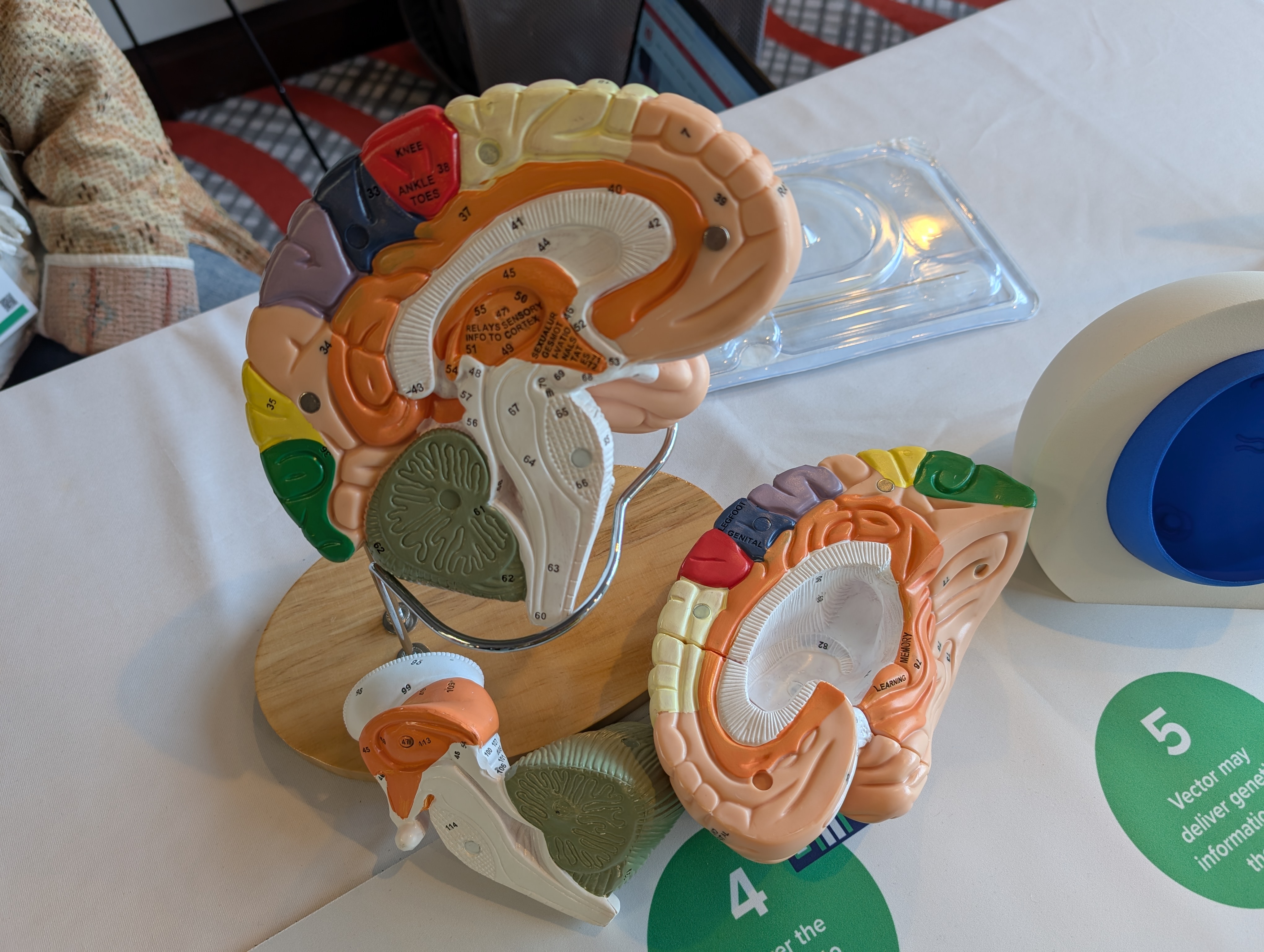 Vendors were present in an exhibit hall, where companies could showcase how they hope their medicines will work to treat Huntington's disease. Here, Spark Therapeutics shows deep brain structures affected in HD.