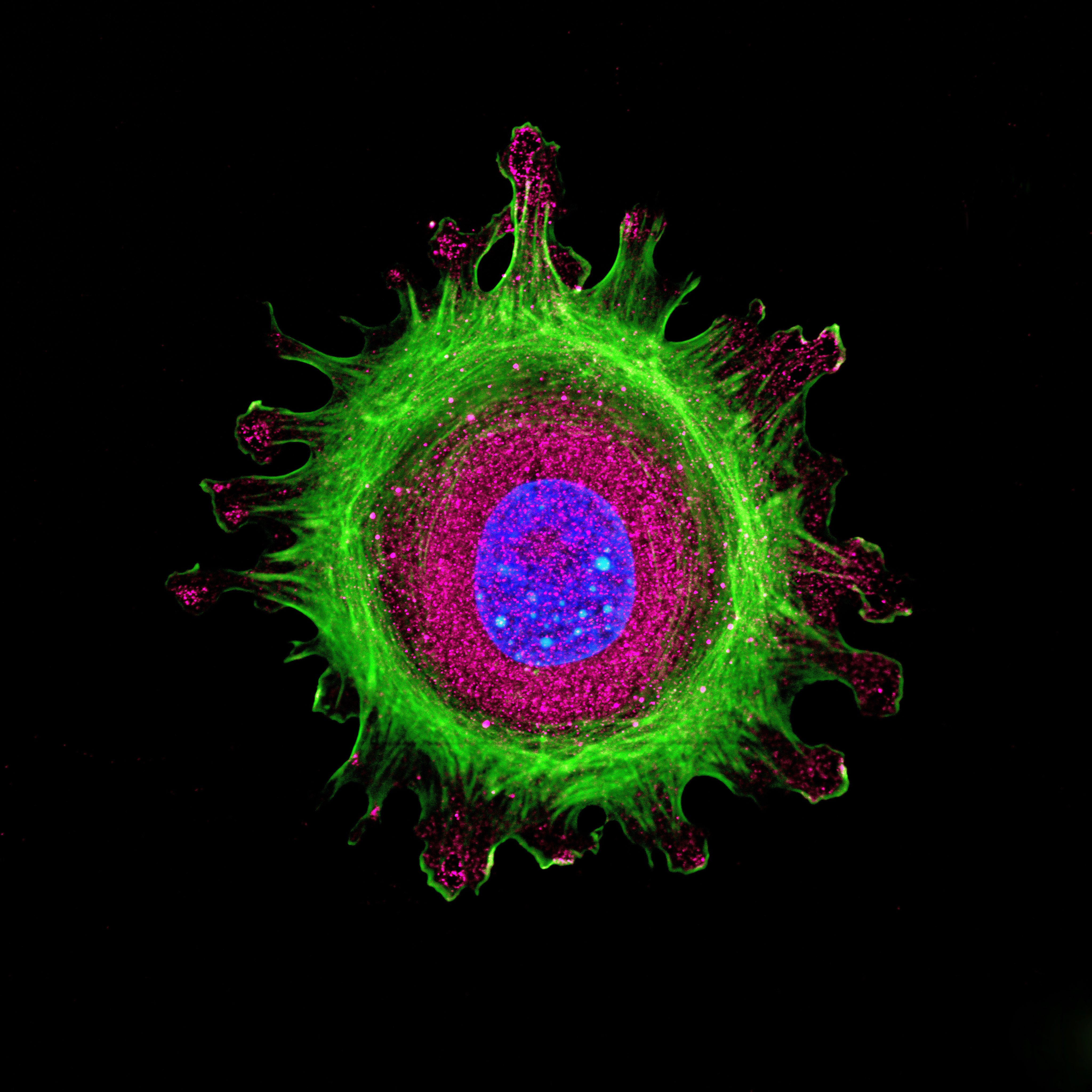 Paraspeckles - the bright blue spots in the center purple spot - are like the VIP dance floor of the cell. Only certain proteins are present in this area, including NEAT1 and Huntingtin, which partner together at those locations.