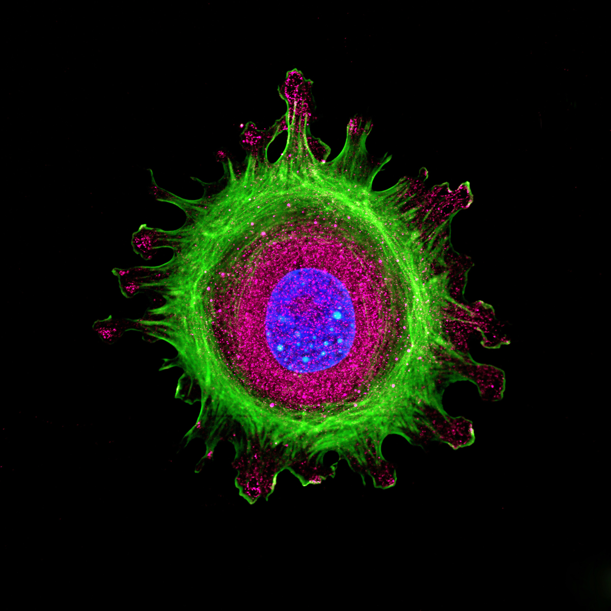 Paraspeckles - the bright blue spots in the center purple spot - are like the VIP dance floor of the cell. Only certain proteins are present in this area, including NEAT1 and Huntingtin, which partner together at those locations.   