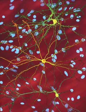 Images of neurons in culture from the Finkbeiner lab. Cells in green and yellow have been 'tagged' so they glow, revealing the shape of the cells.  