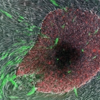 'Induced pluripotent stem cells' in green and red, growing out of surrounding skin cells  