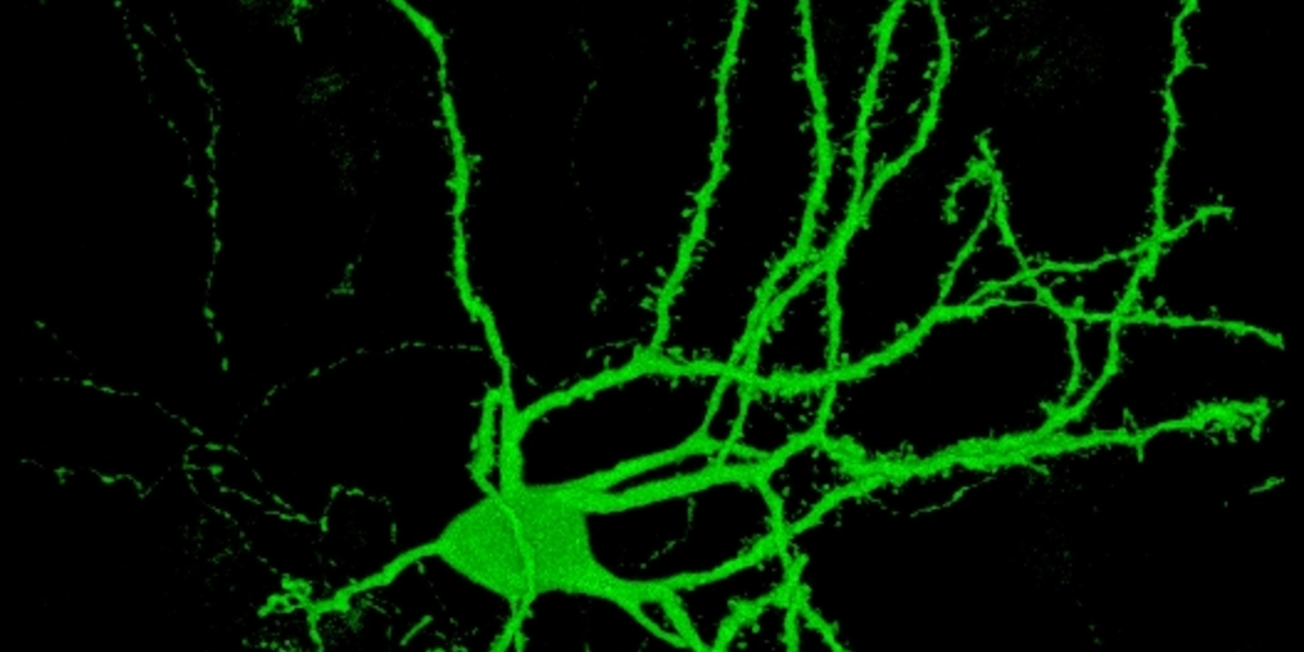 Turning skin cells into brain cells: a Huntington's disease research breakthrough?