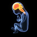The benefits of migration, highlighted in Huntington's disease