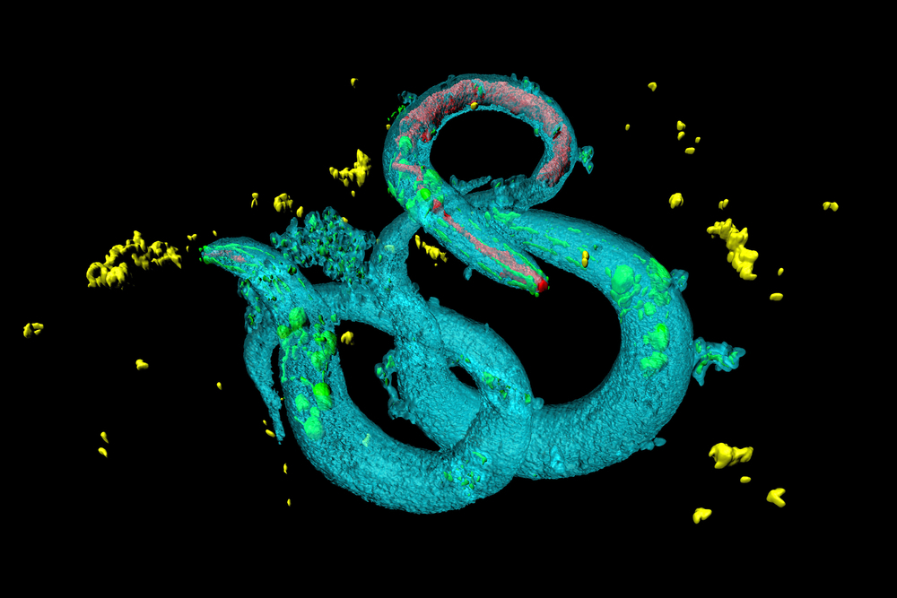 Mallucci's team identified 2 top candidates from testing over a thousand drugs in worms called C elegans.  