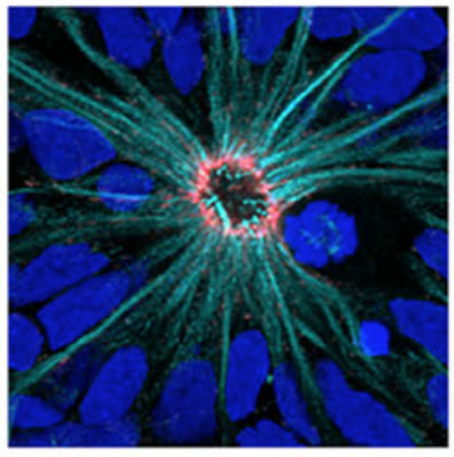 'Neural rosettes' grown in a dish showed some interesting changes when the HD gene was mutated--or when there was no HD gene at all  