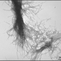 Aggregates of the huntingtin protein, visualized with electron microscopy  