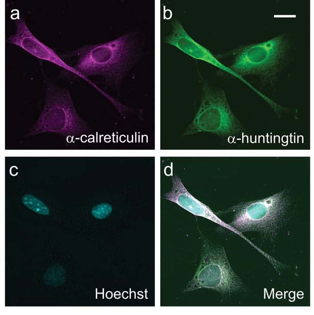 In this microscope image from Truant's lab, different colors are used to show different parts of the cell.  The nucleus is revealed by a dye called 'Hoechst'.  Huntingtin has been made to glow green, allowing it to be pinpointed in the cell.  