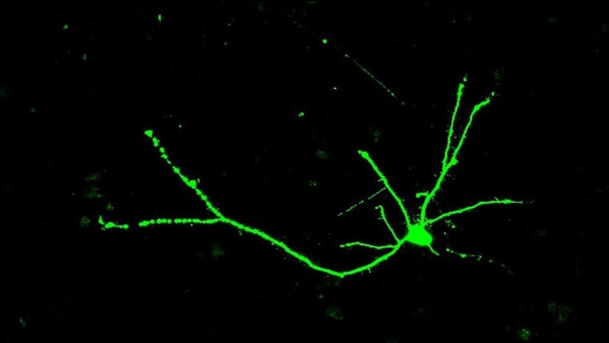 Nerve cells are shaped like trees - with a cell body that contains many branches at the top of the nerve cell, a long trunk, and a branched “root” system at the bottom of the cell.  