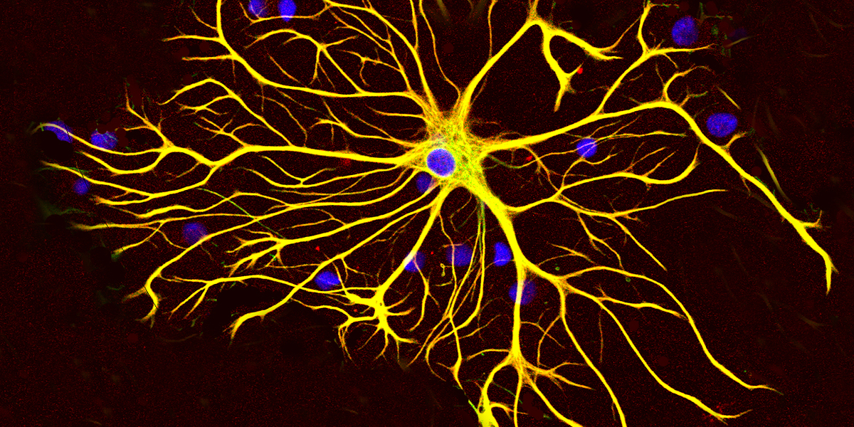 2024 HDBuzz Prize: Beyond nerve cells – who are the other players in the HD brain?