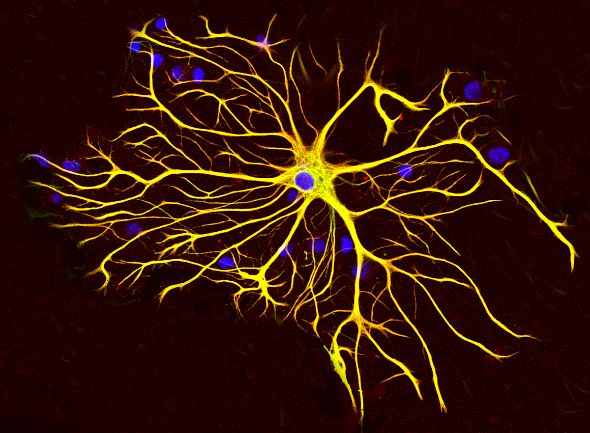 Astrocytes support neuron health by regulating chemicals and nutrients within the brain.  
