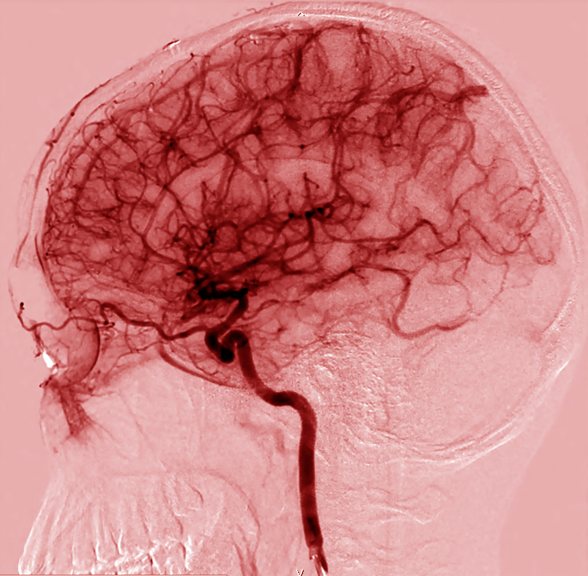 This is an image of the brain’s many blood vessels. The cells that line these vessels create the blood-brain barrier.   