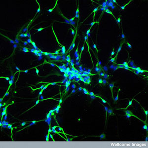 Stem cells can be used to grow neurons in the lab. These neurons are really powerful tools for studying diseases like HD.  