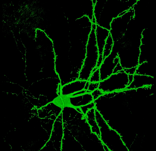 Turning skin cells into brain cells: a Huntington's disease research breakthrough?