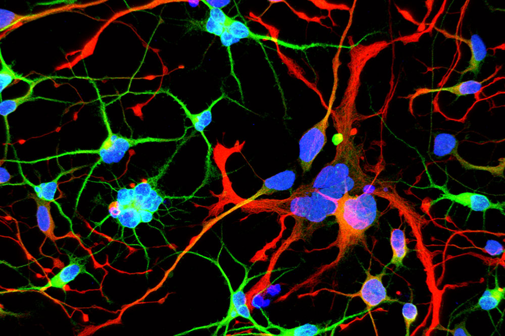 An early role for the Huntington's disease gene – but don't believe all the headlines