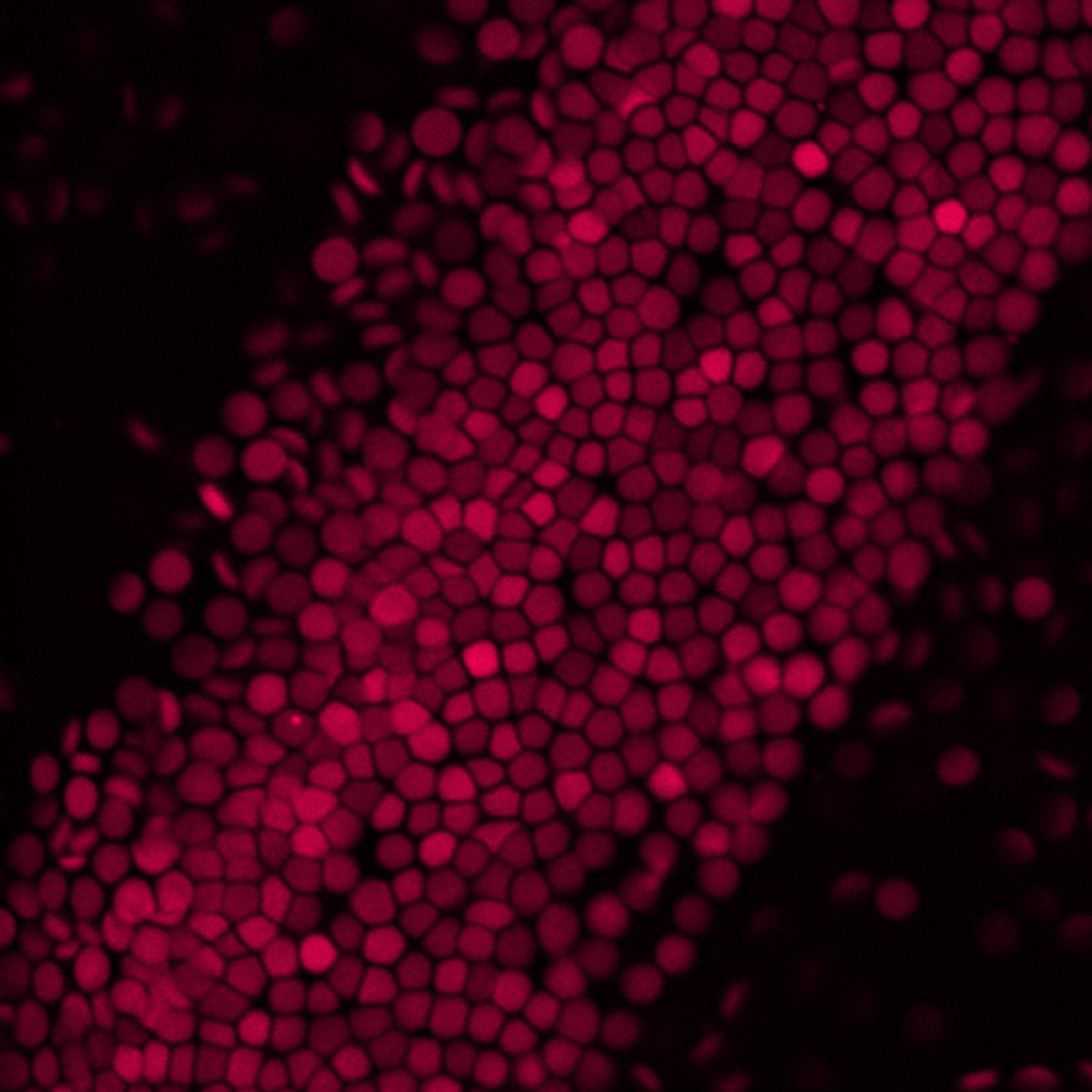 Does blood hold the key to testing treatments earlier in HD patients?