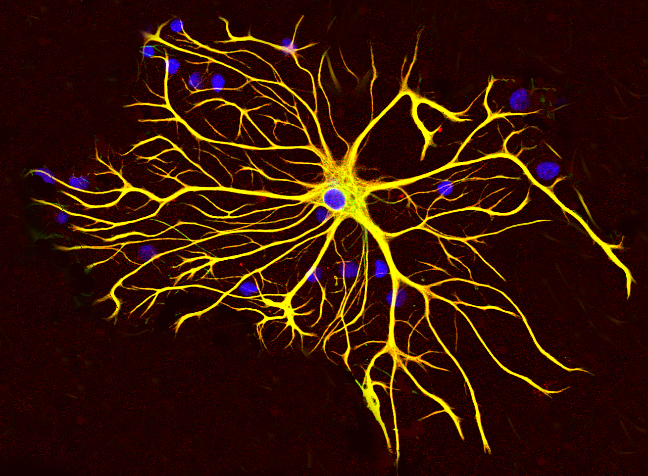 2024 HDBuzz Prize: Beyond nerve cells – who are the other players in the HD brain?